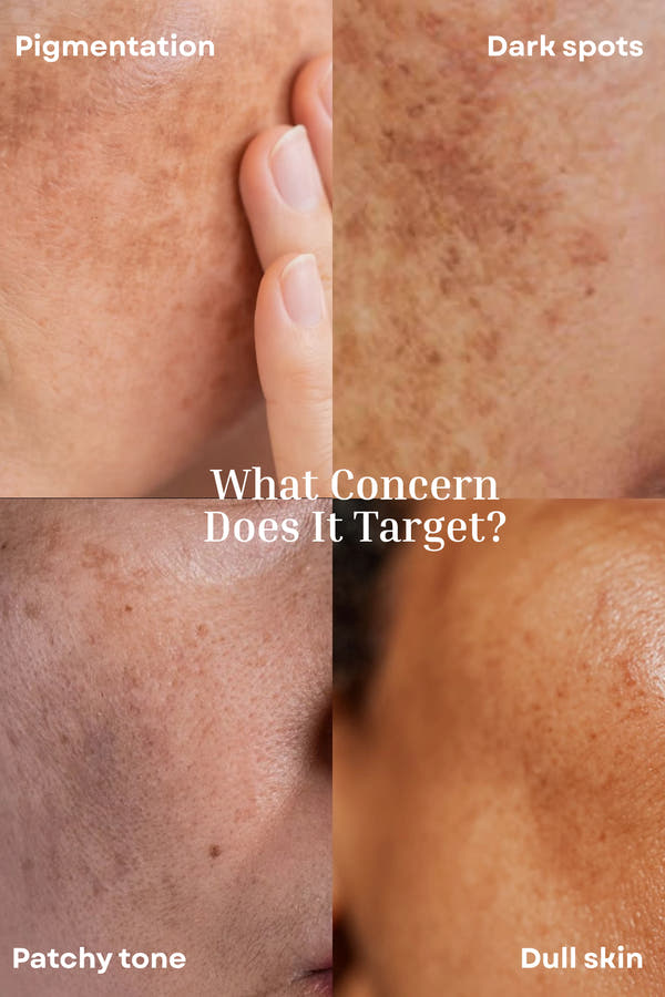 Spotless Glow Face Serum | Fade Spots & Evens Skin tone