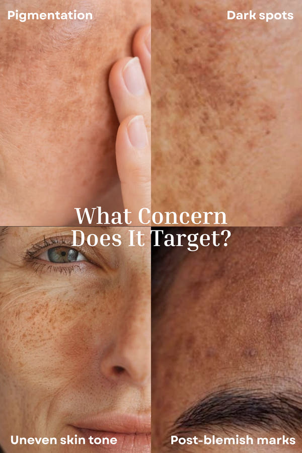 Dark Spot Fade Face Cream Tone Perfecting Night Cream | Enhances Skin Clarity | Helps Visibly Fade Dark Spots & Pigmentation - 30g
